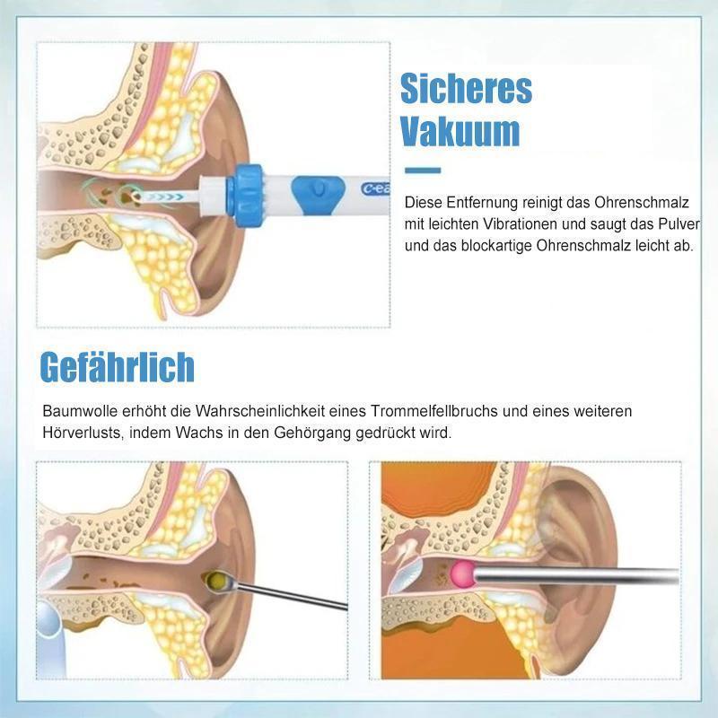 Ohrenschmalzentferner Staubsauger